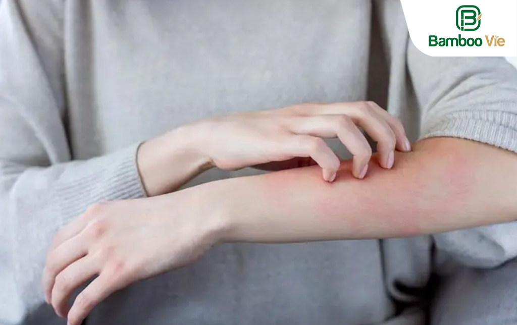 Quần Áo Của Bạn Có Thể Ảnh Hưởng Đến Sức Khỏe Của Bạn Như Thế Nào